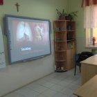 Światowy Dzień Rzucania Palenia w Grodkowicach 